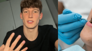 Estudiante de odontología reveló los errores que la mayoría comete con sus dientes