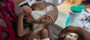 OMS lanza llamado de emergencia sanitaria mundial : IPS Agencia de Noticias