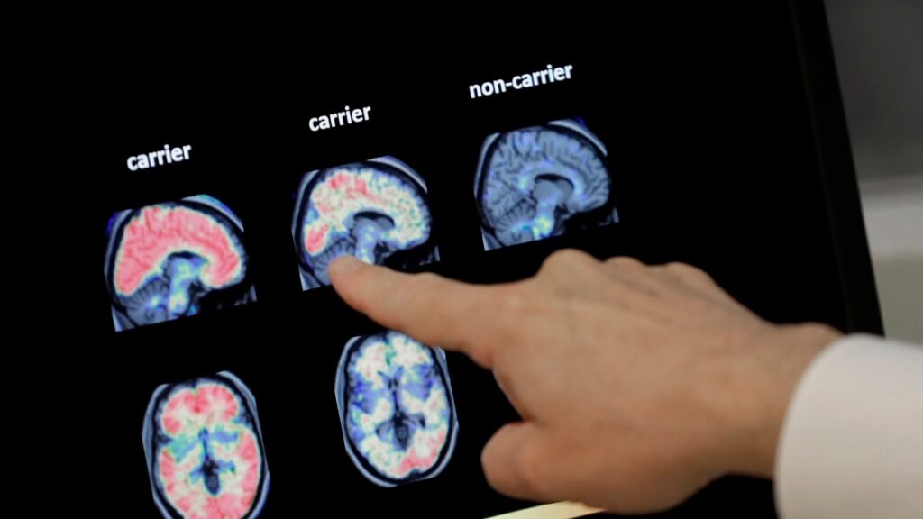Vivir más tiempo podría aumentar el riesgo de demencia, pero hay formas de reducirlo