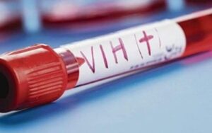 Fin de ayuda de EEUU amenaza la vida de 70 mil personas con VIH/SIDA en Sudán - AlbertoNews
