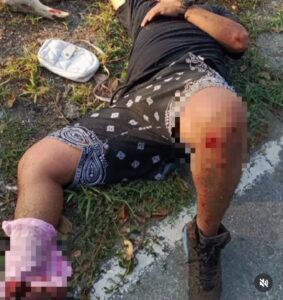 Motorizado derrapó en Naiguatá y paró en la playa