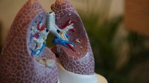 Neumonía bilateral: Una afección respiratoria seria