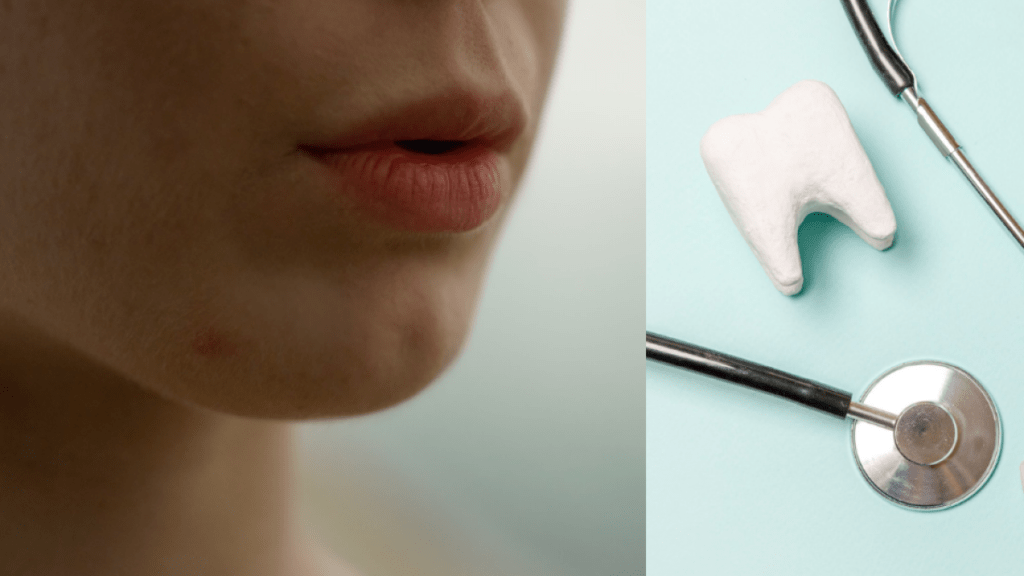 Odontóloga advierte de los riesgos en los dientes y la salud oral de respirar por la boca