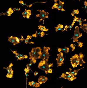 los macrófagos extraen nutrientes de las bacterias o virus que ingiere