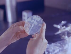 Crisis de financiación pone en riesgo años de avance en lucha contra tuberculosis : IPS Agencia de Noticias