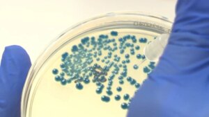 Descubren un nuevo antibiótico para atacar a las superbacterias