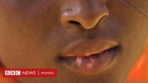 "Llené de cicatrices a mis 6 hijos al utilizar cremas para aclarar sus pieles": la epidemia de "decoloración" que llevó a Nigeria a declarar el estado de emergencia