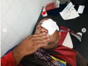 Vendedor de caramelos agredió a chofer con un ladrillo