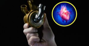 implantan un corazón de titanio y el paciente sobrevive 100 días antes del trasplante, un avance sorprendente tras 20 años de investigación