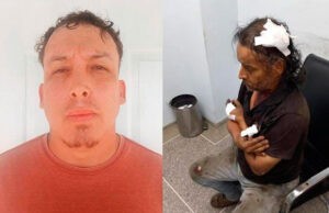 Agredió múltiples veces a la víctima con un tubo