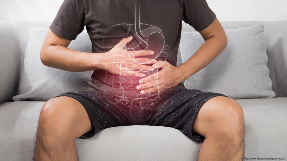 Apendicectomía podría ayudar a personas con colitis ulcerosa – DW – 16/04/2025