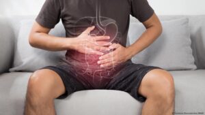 Apendicectomía podría ayudar a personas con colitis ulcerosa – DW – 16/04/2025