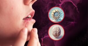 Científicos muestran cómo el herpes daña el cerebro y altera el comportamiento al activar una vía inflamatoria específica