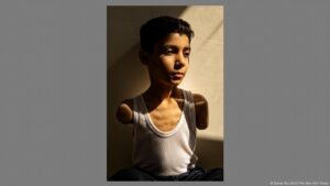 Foto del Año del World Press Photo – DW – 17/04/2025