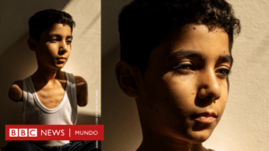 La historia de la impactante imagen de un niño palestino mutilado que ganó el premio World Press Photo 2025