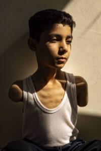 La imagen de Mahmoud, un niño mutilado de Gaza, foto del año del World Press Photo