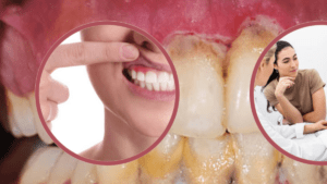 La periodontitis podría ser un factor que dificulte la fertilidad: ¿de qué se trata?