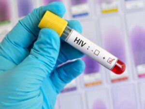 Red Somos desmiente supuesto brote de VIH en Colombia | Regiones | Economía