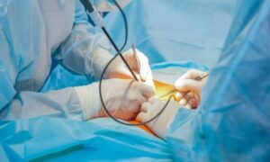 se olvidaron un bisturí eléctrico sobre las piernas de la mamá y quemaron a su bebé