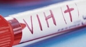 ¿Brote de VIH en Carabobo? Esto es lo que dice un experto