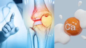 ¿cómo reducir sus niveles en la sangre?
