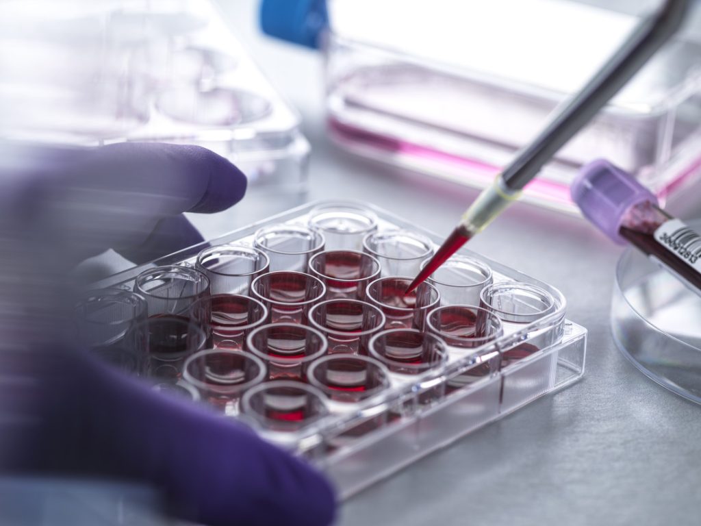 Conoce algunas técnicas de detección temprana del cáncer