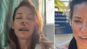 Evangeline Lilly, actriz de 'Lost' y 'Ant-Man', mostró fotos y contó detalles del doloroso accidente que sufrió en la playa: 'Fue un reinicio'