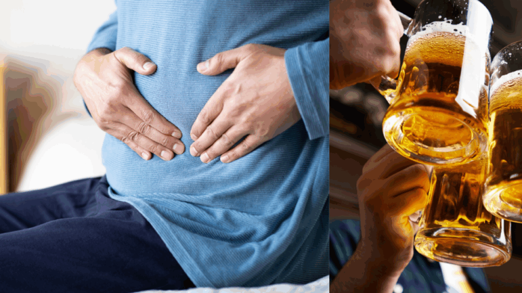 Hombre pensó que la inflamación de su estómago era por beber cerveza, pero resultó ser cáncer de intestino