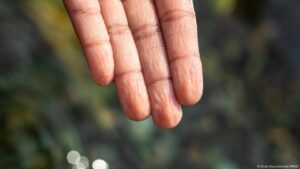 La pregunta de un niño desvela misterio de los dedos mojados – DW – 15/05/2025