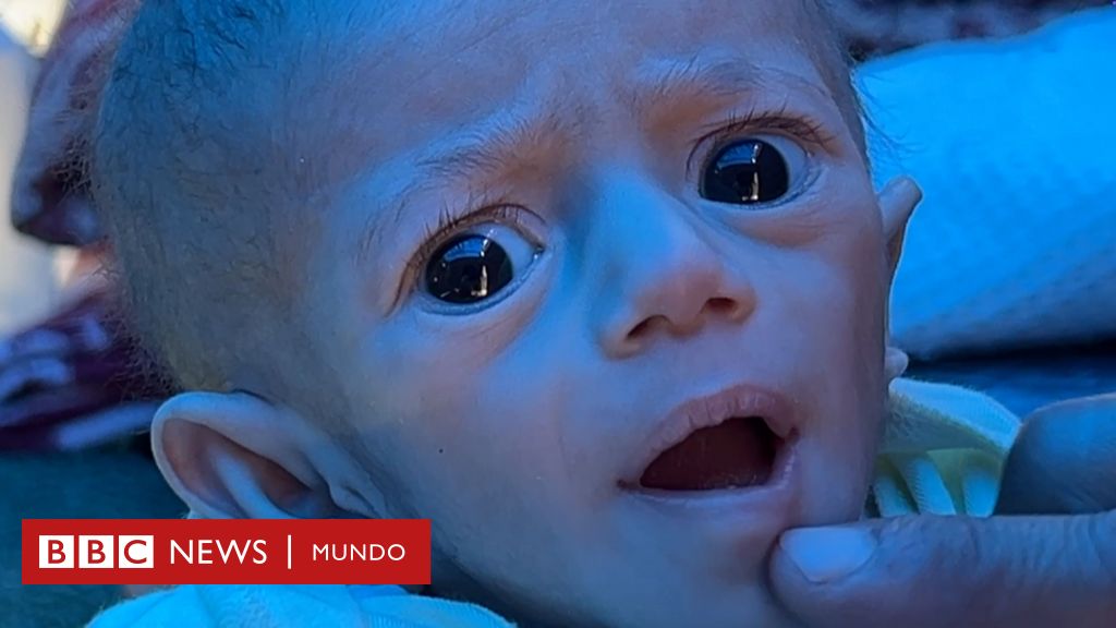 "La situación es desesperada": la BBC regresa al sitio en Gaza donde una bebé casi muere de hambre debido al bloqueo israelí