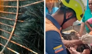 Rejilla de ventilador se desprendió e incrustó en la cabeza de una mujer