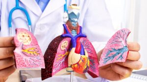 Reportan 111 casos de tuberculosis en la cárcel Modelo de Bucaramanga: ¿Cómo se está controlando?