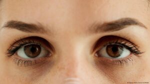 médicos utilizan fotos para calcular edad biológica – DW – 09/05/2025