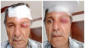 Así va el caso del camarógrafo agredido por motociclista en Cali