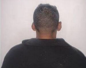 Detenido en Miranda por amputar la mano de un hombre con un machete durante una discusión