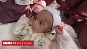 "El primer y último objetivo de este viaje es Siwar": la niña palestina desnutrida que la BBC filmó en Gaza llega a Jordania para su tratamiento