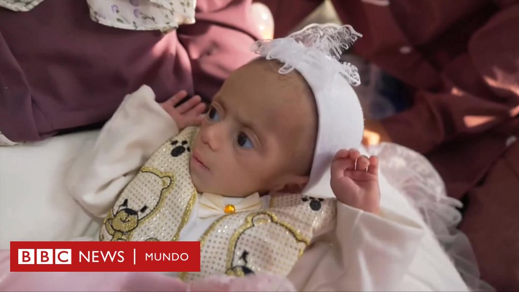 "El primer y último objetivo de este viaje es Siwar": la niña palestina desnutrida que la BBC filmó en Gaza llega a Jordania para su tratamiento