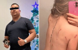 Fue apuñalada 28 veces por su expareja y sobrevivió – Diario La Nación