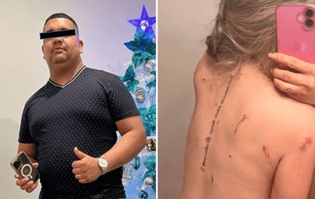 Fue apuñalada 28 veces por su expareja y sobrevivió – Diario La Nación