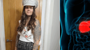 Joven de 24 años fue diagnosticada con cáncer de páncreas en etapa 4 luego de que se negaron a atenderla por su edad: ‘Demasiado tarde e incurable’