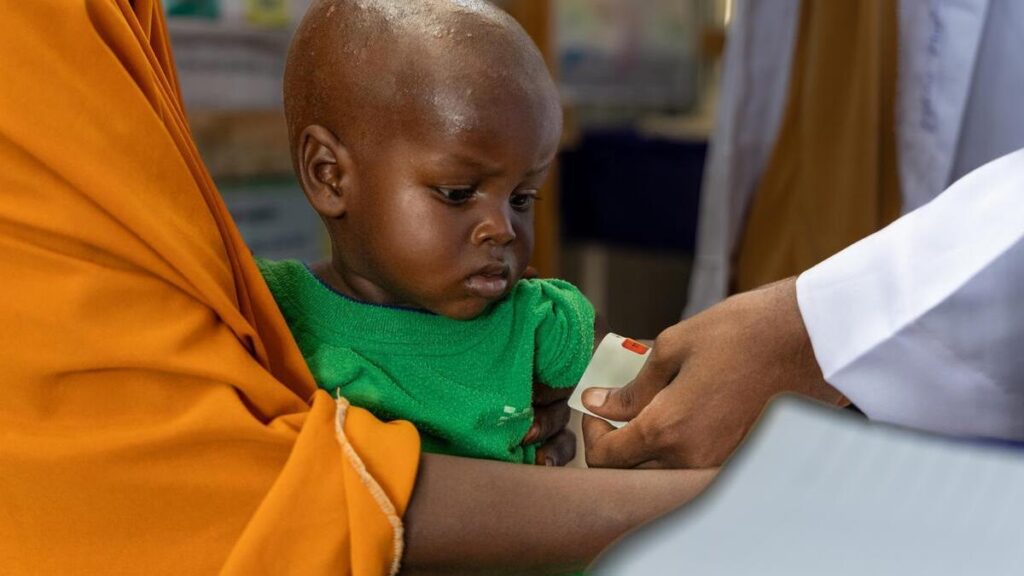 Bebé en un campamento de desplazados internos, Somalia.