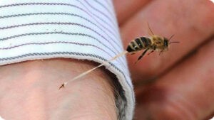 Murió septuagenario tras ataque de abejas africanas
