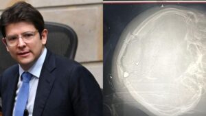 el estado de Uribe es de máxima gravedad y su pronóstico es reservado
