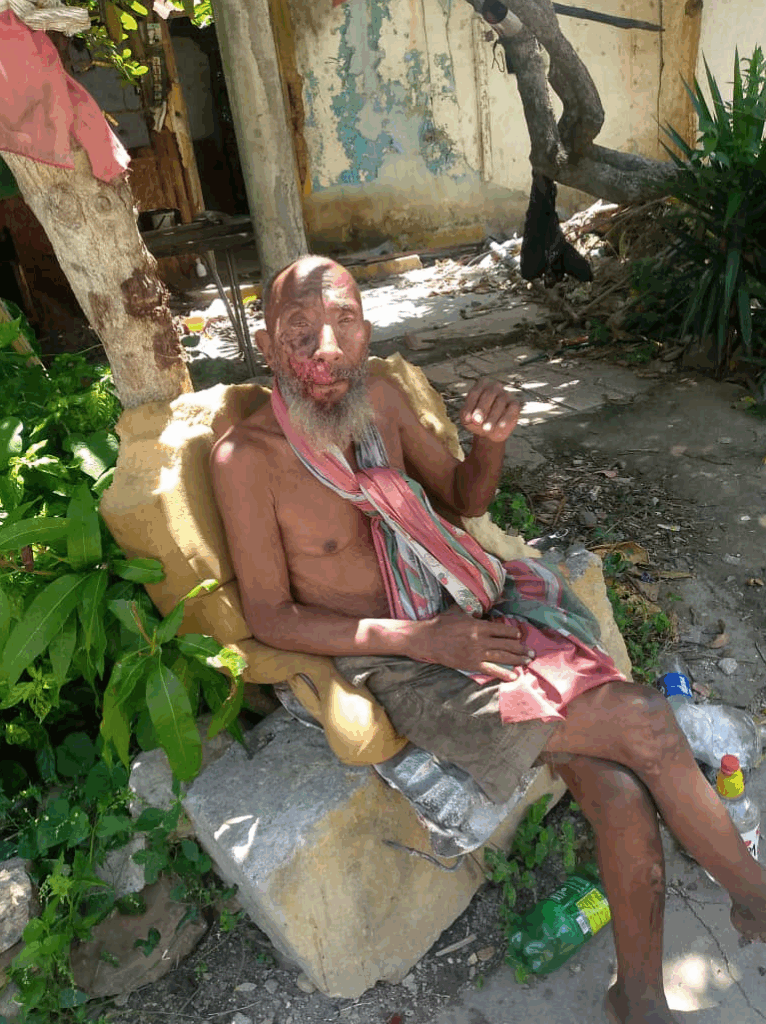 Abuelo está muriendo de mengua en Chichiriviche