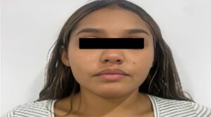 Arrestan a mujer involucrada en el homicidio de un hombre en Coro
