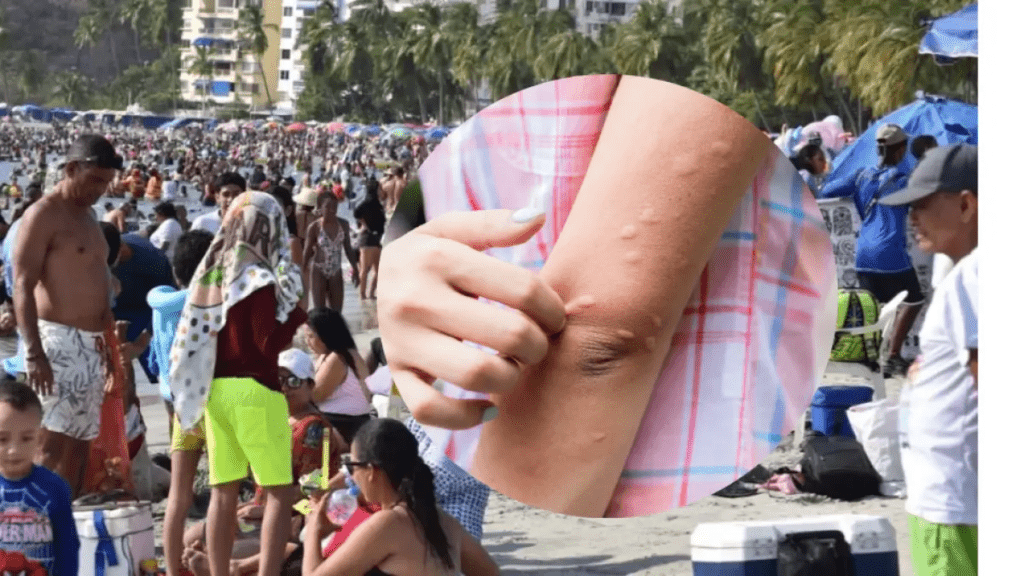 Bañistas denuncian brotes en la piel tras ingresar al mar en Santa Marta; mujer afectada cuenta su experiencia