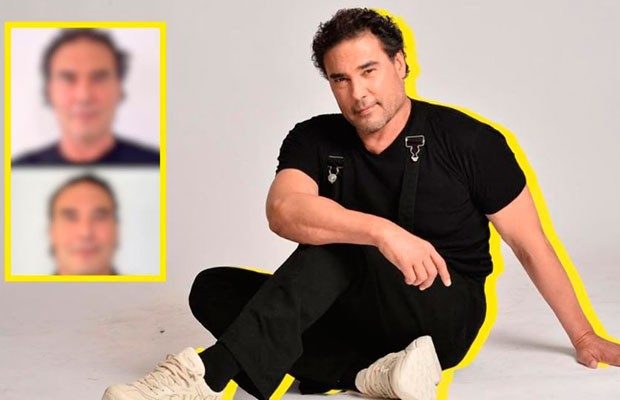 Eduardo Yáñez se somete a tratamiento estético para lucir más joven