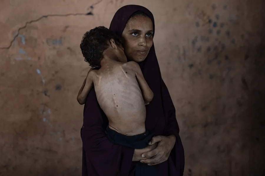 Han muerto más gazatíes por desnutrición en lo que va de 2025 que en los dos años previos – Diario La Nación