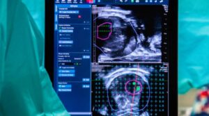 La IA podría desplazar para siempre el antiguo método para detectar el cáncer de próstata