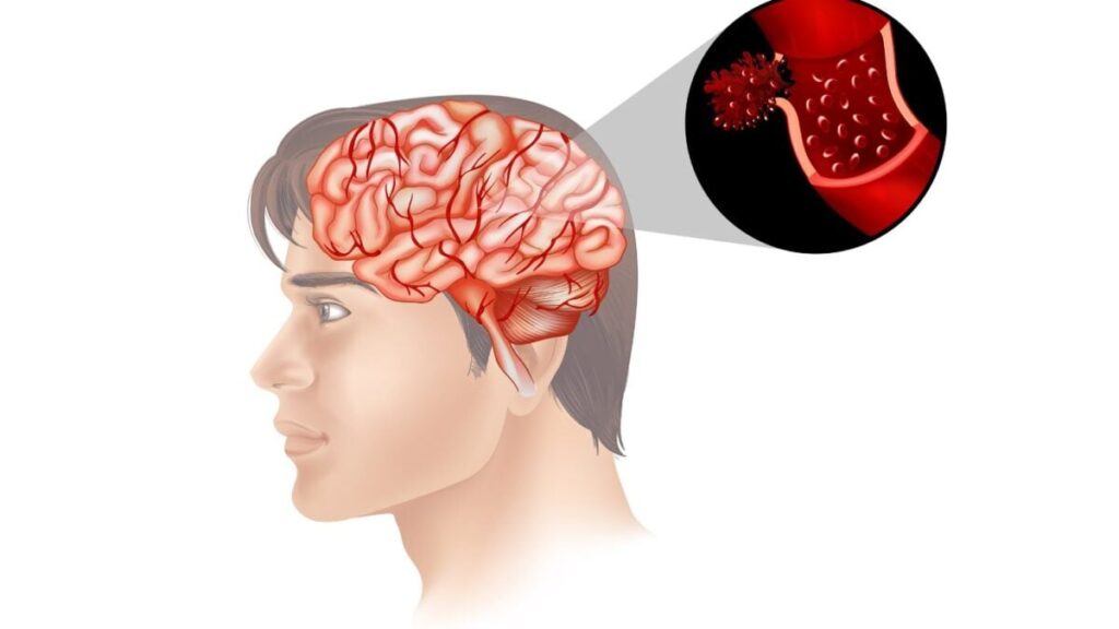 Lo que respiras podría estar afectando a tu cerebro más de lo que imaginas